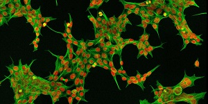 Immunofluorescence